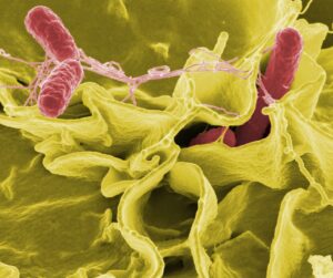 bacteria, salmonella, pathogens-67659.jpg