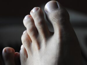 feet, man feet, foot-2429438.jpg