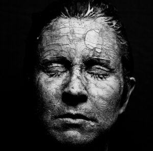 woman, dry skin, face-4402587.jpg